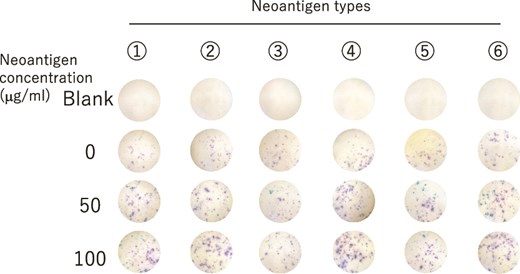 IFN-γ secretion in lymphocytes from PBMCs after the six course of neoantigen DC vaccination therapy was evaluated by ELIspot assay.