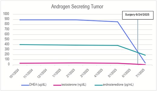 DHEA, testosterone, and androstenedione levels before and after resection. This graph shows serial measurements of DHEA (ug/dL), testosterone (ng/dL), and androstenedione (pg/mL) throughout the patient’s clinical course. At time of presentation, DHEA was elevated to 892 ug/dL (normal value 5–115), testosterone elevated to 28.7 (normal value <2.4), and androstenedione elevated to 403 pg/mL (normal value 30–300). After resection of the right adrenal gland, all of these values normalized.