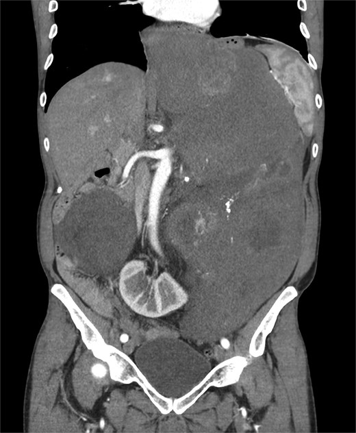 Sagittal CT scan.