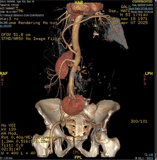 3D reconstruction, CT angiography.