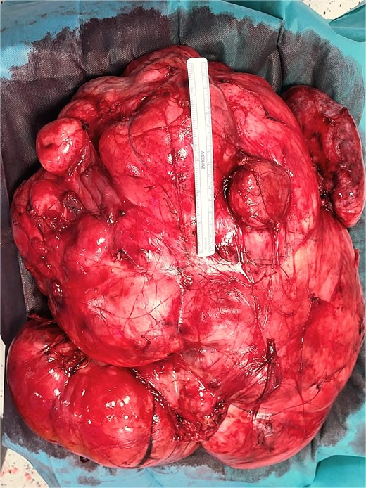 Intraoperative photograph.