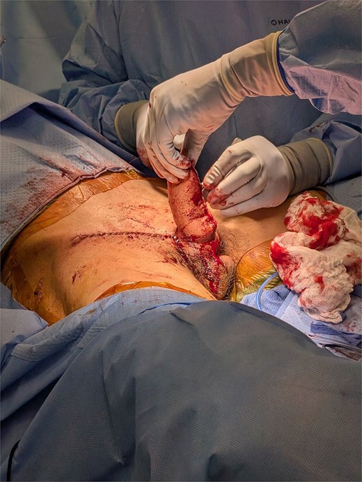 Intraoperative results.