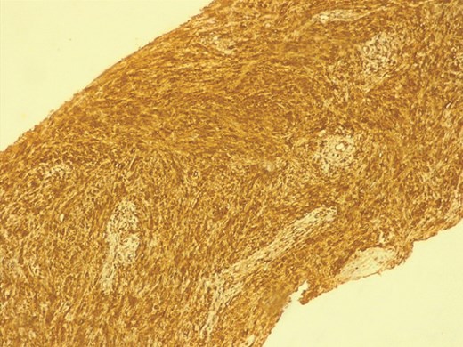 The immunohistochemistry findings.