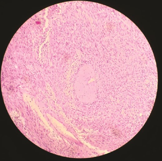 Microscopic histopathological examination.