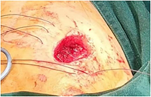 Neatly arranged sutures.