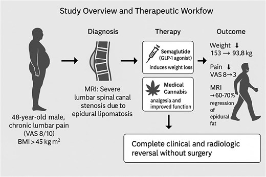 Study overview and therapeutic workflow leading to complete reversal of spinal epidural lipomatosis. This schematic summarizes the diagnostic pathway, therapeutic strategy, and clinical outcomes in a 48-year-old man with severe lumbar spinal canal stenosis caused by spinal epidural lipomatosis.