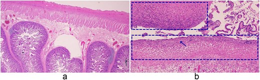 Histopathologic features of the small intestine and peritoneum. (a) Small intestine (2×), (b) small intestine with peritonitis (10×). (a) Low-power view of the small intestine showing preserved villous architecture and intact serosa. (b) Higher magnification (10×) demonstrating necrotic tissue within the dashed area, with dense neutrophilic infiltration (arrows), appearing as numerous small dark-staining cells, and purulent exudate on the serosal surface.
