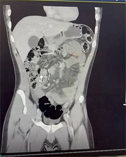 CT image.