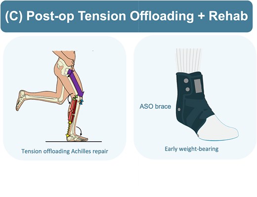 Illustrations showing postoperative rehabilitation and tension offloading strategy.