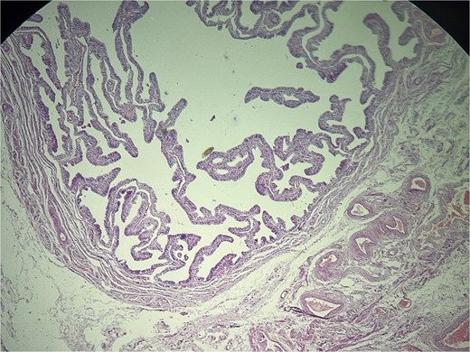Left fallopian tube and adjacent mesosalpinx without significant histopathologic abnormality. Hematoxylin and eosin (H&E) stain, ×40.