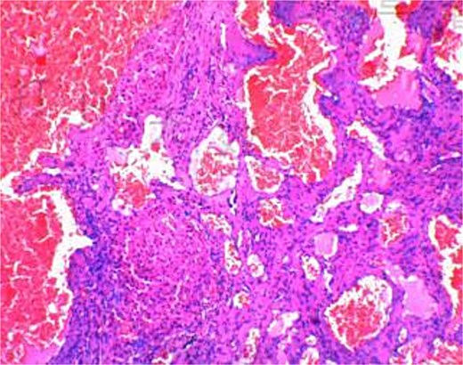 Pathological report.