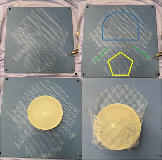 The mesh and creation of pocket around the implant.