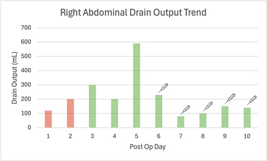Bar graph of post operative daily drain outputs, where Days 1 and 2 the drain fluid quality was haemoserous, becoming bilious from Day 3 onwards. The syringe symbol indicates the introduction of Octreotide 100 μg subcutaneous three times daily injection.