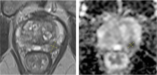 For image description, please refer to the figure legend and surrounding text.