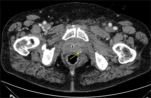 For image description, please refer to the figure legend and surrounding text.