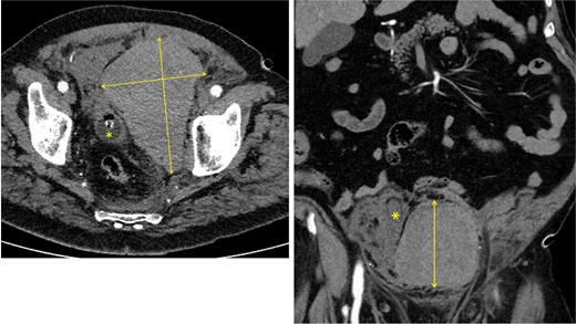 For image description, please refer to the figure legend and surrounding text.