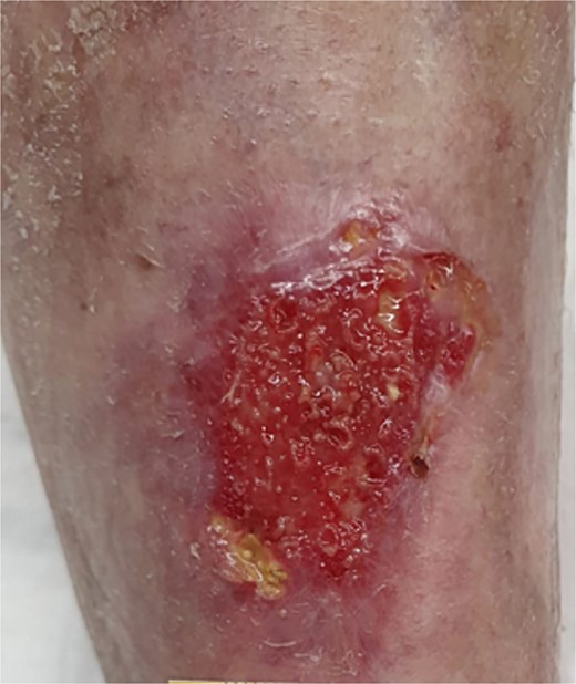 Six weeks postoperatively.