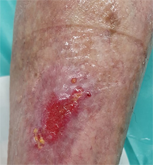 Eight weeks postoperatively.