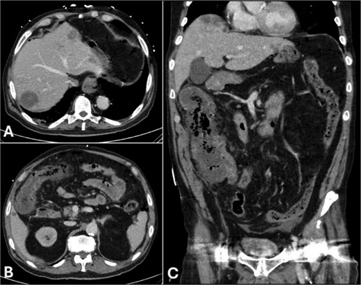 For image description, please refer to the figure legend and surrounding text.