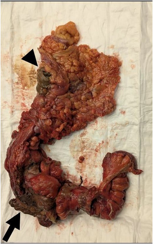 For image description, please refer to the figure legend and surrounding text.