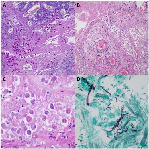 For image description, please refer to the figure legend and surrounding text.