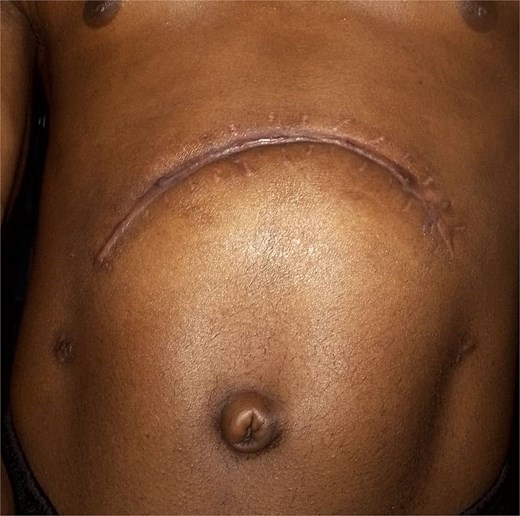 An image of the patient achieving full recovery.