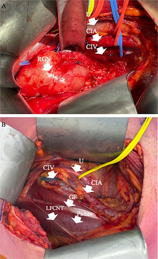For image description, please refer to the figure legend and surrounding text.
