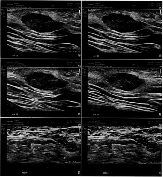 For image description, please refer to the figure legend and surrounding text.