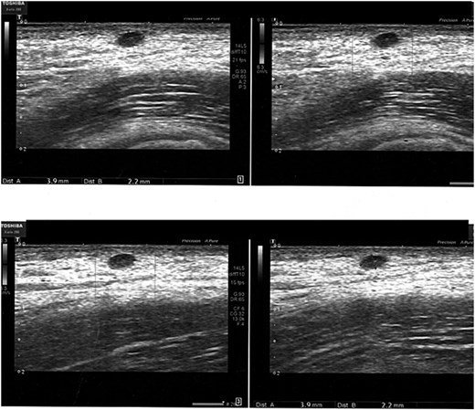 For image description, please refer to the figure legend and surrounding text.