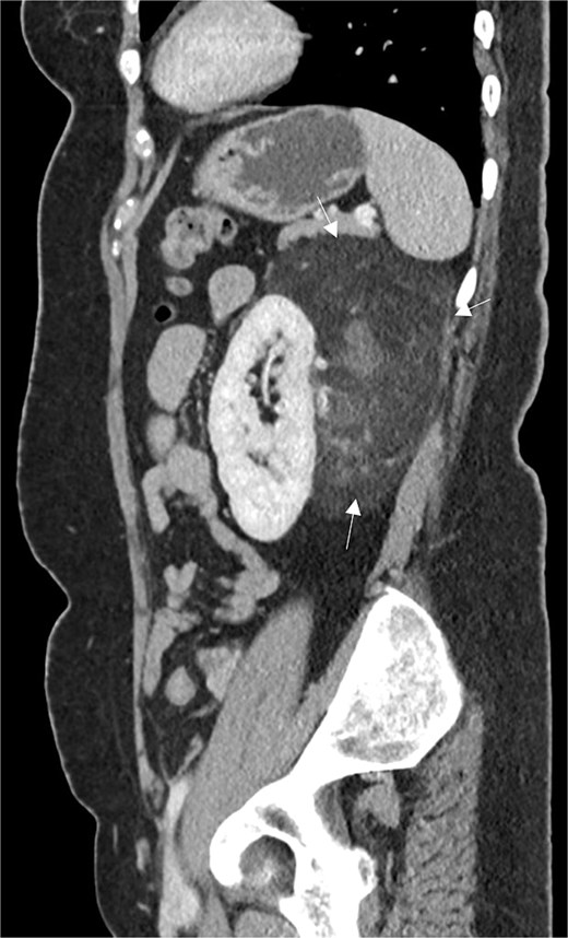 For image description, please refer to the figure legend and surrounding text.