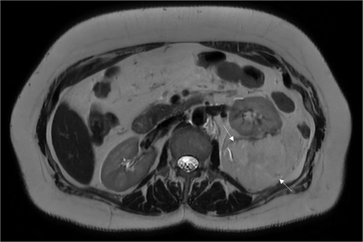 For image description, please refer to the figure legend and surrounding text.