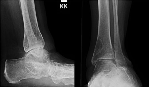 For image description, please refer to the figure legend and surrounding text.