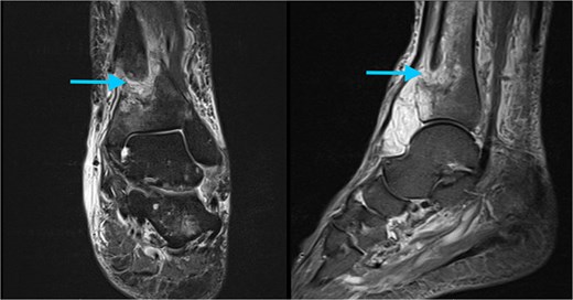 For image description, please refer to the figure legend and surrounding text.