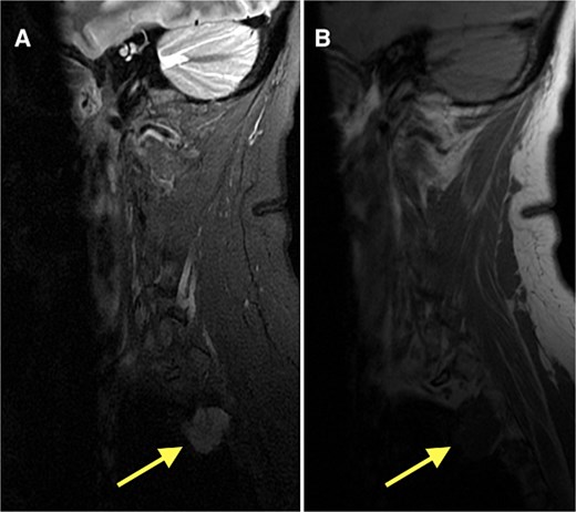 For image description, please refer to the figure legend and surrounding text.