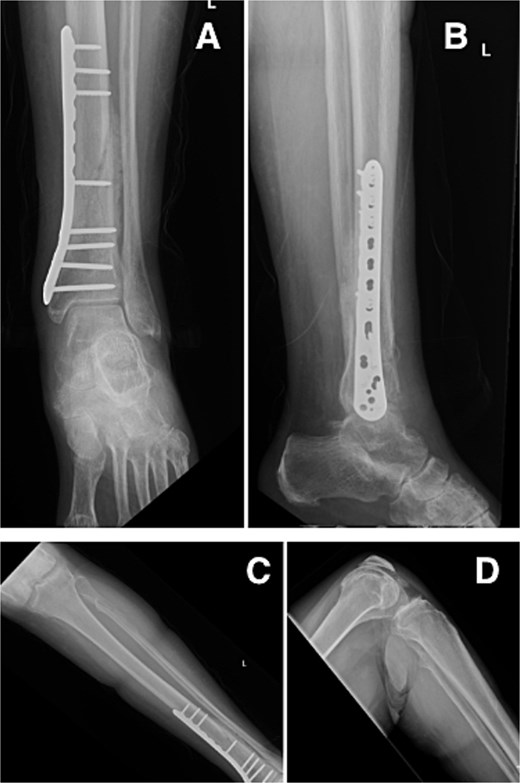 For image description, please refer to the figure legend and surrounding text.