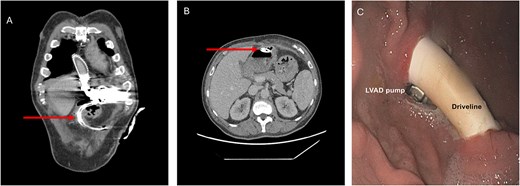 For image description, please refer to the figure legend and surrounding text.