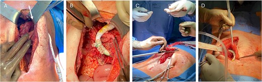 For image description, please refer to the figure legend and surrounding text.