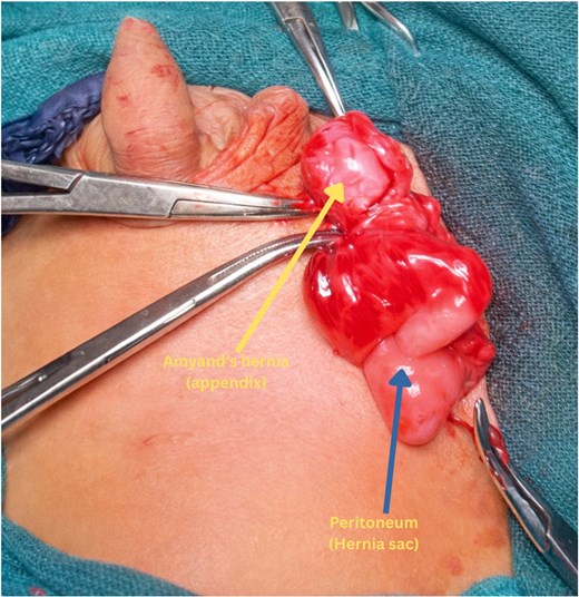 For image description, please refer to the figure legend and surrounding text.