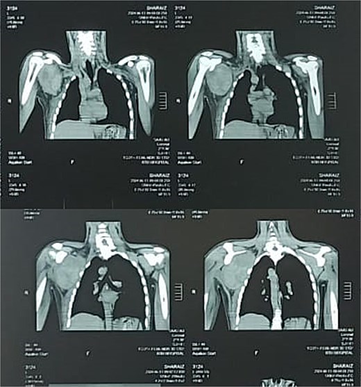 For image description, please refer to the figure legend and surrounding text.