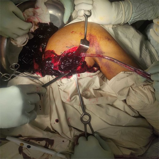 For image description, please refer to the figure legend and surrounding text.