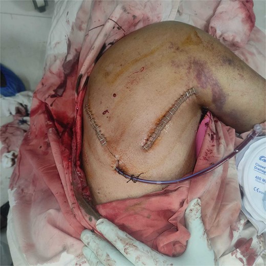 For image description, please refer to the figure legend and surrounding text.