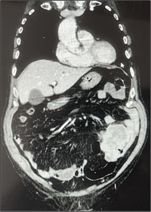 For image description, please refer to the figure legend and surrounding text.