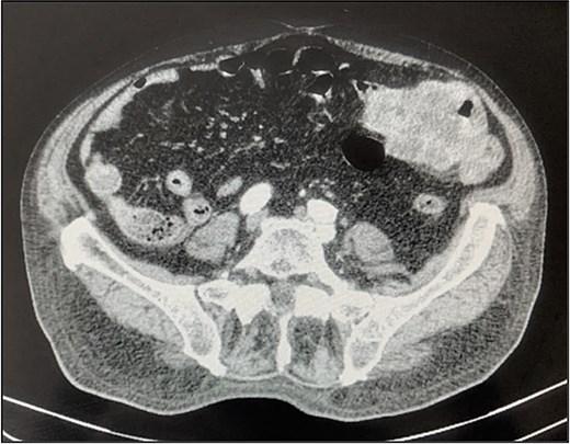 For image description, please refer to the figure legend and surrounding text.