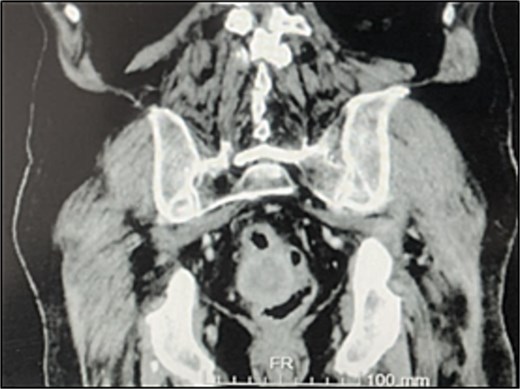 For image description, please refer to the figure legend and surrounding text.