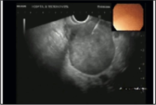 For image description, please refer to the figure legend and surrounding text.