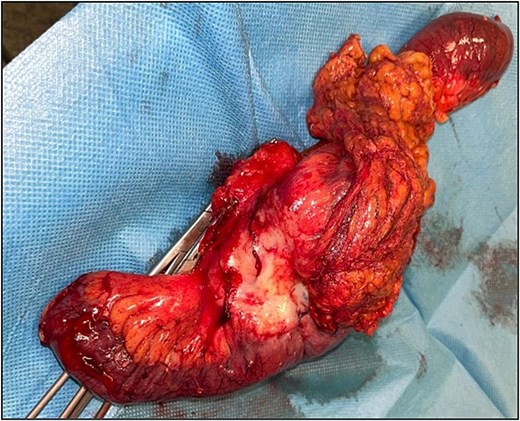 For image description, please refer to the figure legend and surrounding text.