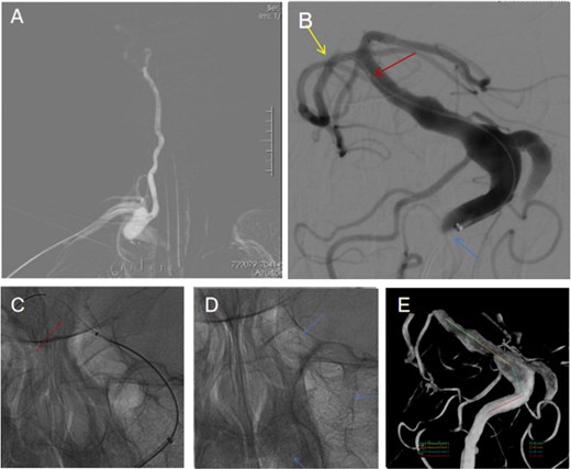 For image description, please refer to the figure legend and surrounding text.