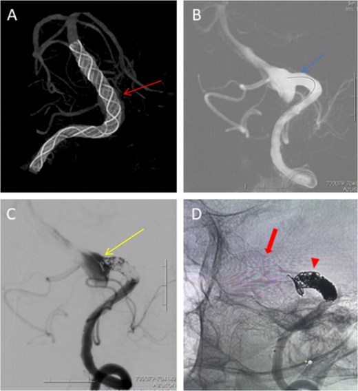 For image description, please refer to the figure legend and surrounding text.