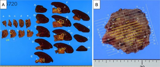 For image description, please refer to the figure legend and surrounding text.