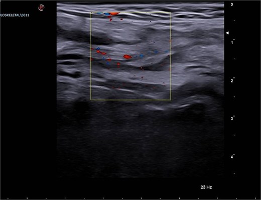 For image description, please refer to the figure legend and surrounding text.